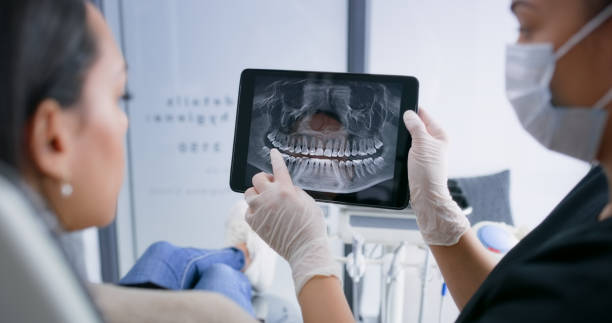 Licensed Tooth Extraction service in Bibb County County, GA - Smile Center Dentistry